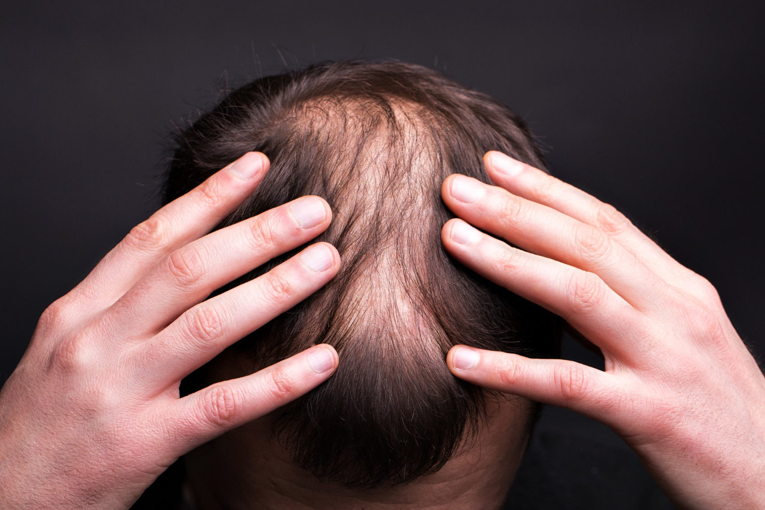 Is PP405 the Future of Hair Regrowth? What We Know So Far